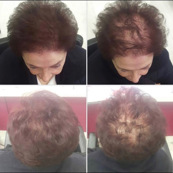 Pócima de Rapunzel (RAPUNZEL´S POTION) - Picture 4 of 7